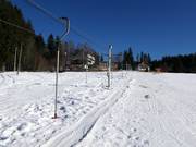 Sirotek I. (E) - Téléski