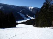 Pistes noires au télésiège Großbergbahn