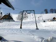 Poche - Téléski à pioches