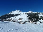 Vue sur Lech avec Schlegelkopf