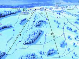 Domaine skiable U Čápa – Kořenov-Příchovice