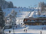 Oberer Wilddieblift - Téléski à pioches
