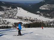 Vue depuis le Köhlerhagen vers le Ritzhagen